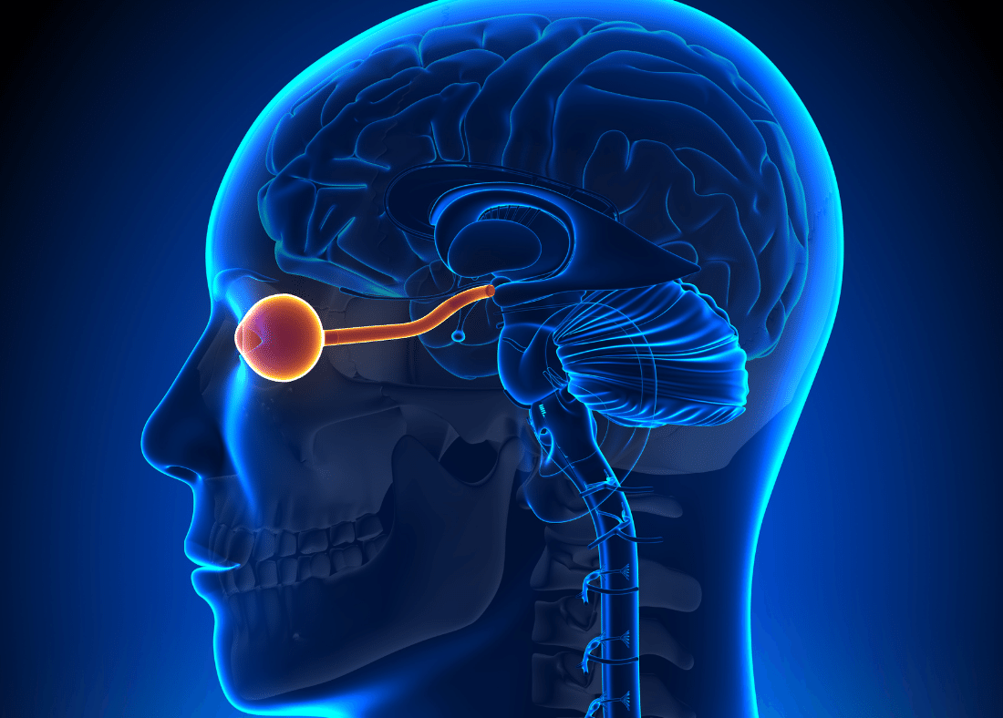 optic nerve injury